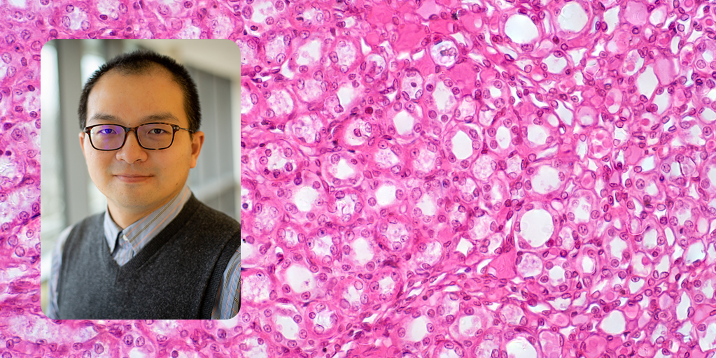 Photo of BHI assistant professor Juexin Wang and background image of stained kidney cells