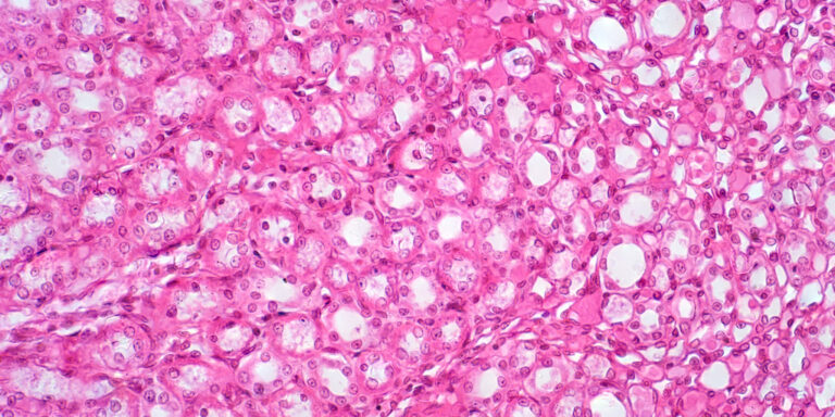 Pink, eosin-stained kidney cells as seen under microscope